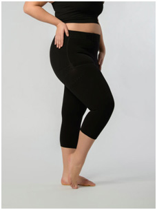 Lipedema